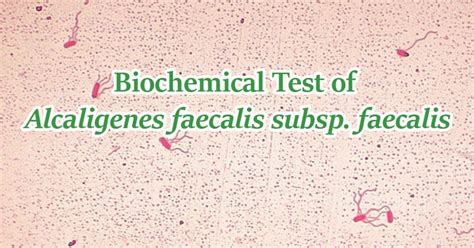 alcaligenes faecalis biochemical tests|Biochemical Test of Alcaligenes faecalis subsp..
